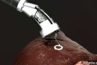 Direct Organ Regeneration with 3D Bioprinting