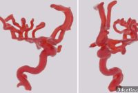 Precision Brain Vasculature Replicas from Silicone 3D Printing