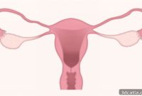Innovative 3D Printed Ovules Offer New Hope for Endometriosis