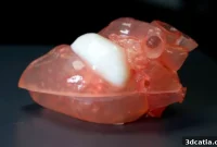 The Rise of Medical 3D Printing in the American Midwest