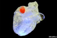 Sonic Construction: In-Body 3D Printing with Ultrasound