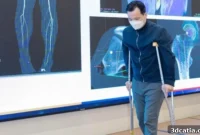 Vietnam Pioneers 3D Printed Implants for Bone Cancer Breakthrough