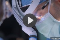 Healthcare’s Future, Molded: 5 Innovations in Medical 3D Printing