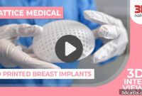Lattice Medical’s 3D Printed Implants: 5 Videos Revealing the Future