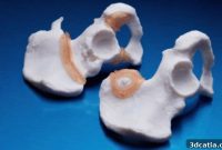 Ricoh and Insight Surgery Elevate Surgical Precision Through 3D Printing