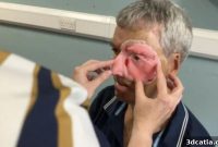Cyclist’s New Beginning: How 3D Printing Rebuilt His Face