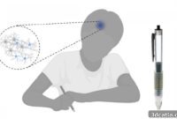 Diagnosing Parkinson’s Disease with a 3D Printed Pen