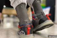 Prothesia: Empowering Latin America Through Orthotics and Prosthetics