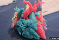 Additive Manufacturing Fuels Medical Market Growth