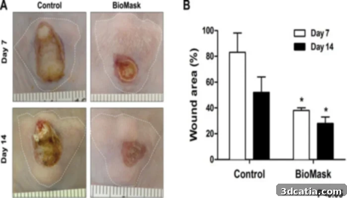 3D Bioprinted BioMask for facial wound healing