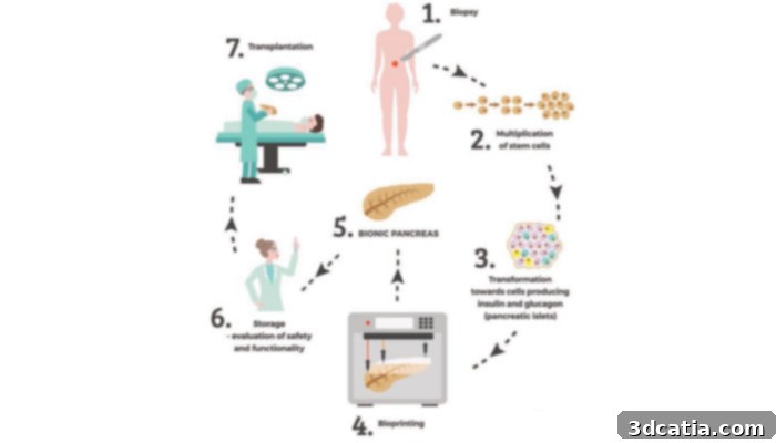 3D Bioprinting Process for Bionic Pancreas