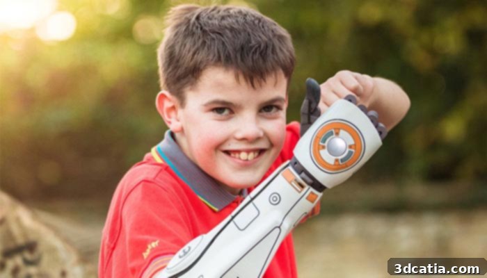 open bionics