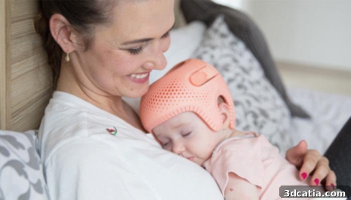 Invent Medical 3D printed cranial remolding helmet
