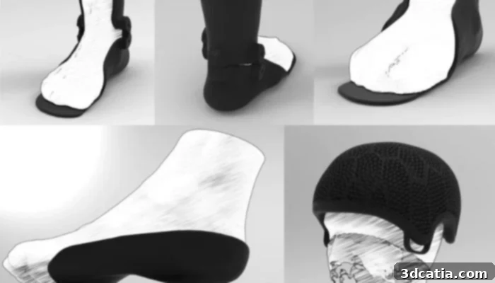 Korthotics 3D printed orthoses for foot and ankle