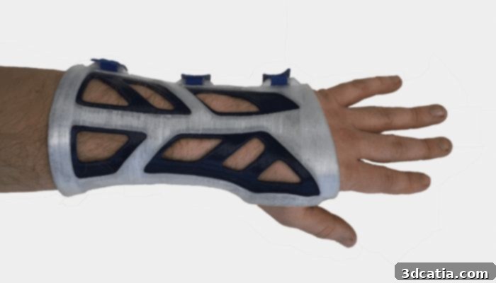 Think3DDD 3D printed orthosis for a human arm