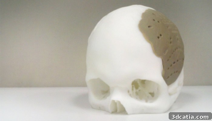 3D Printed PEKK Skull Implant for Bone Regeneration Research