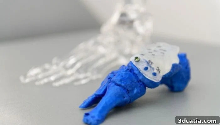 Macquarie University 3D printed ankle implant