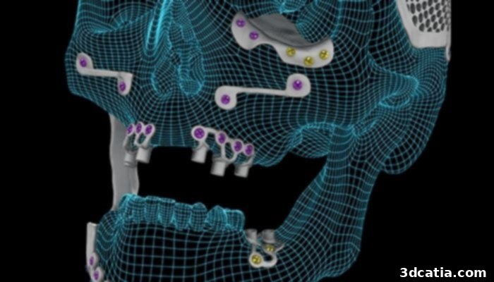 AB Dental 3D printed implant