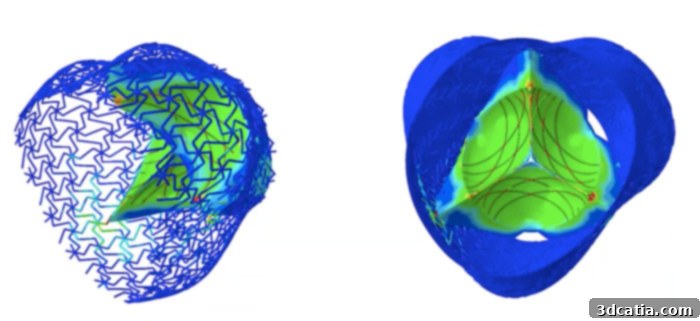 3D printed heart valve