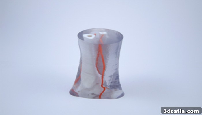 AVINENT dental implants