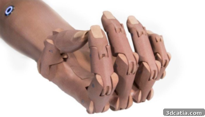 Unlimited Tomorrow realistic 3D printed prosthesis