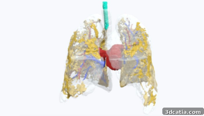 Life-size 3D printed lung model illustrating COVID-19 infection severity