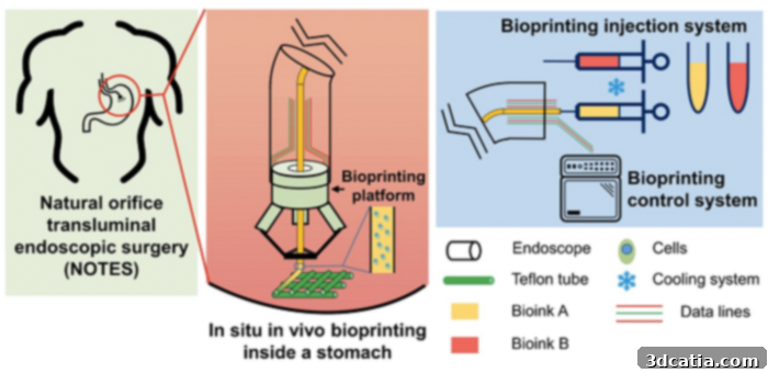 Bioprinting onto stomach