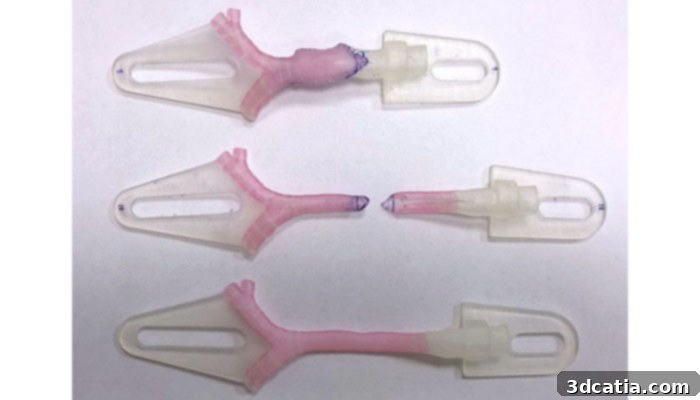 3D printed anatomical models for tracheoplasty