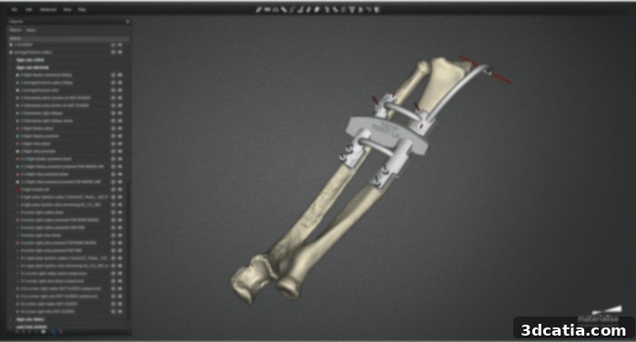 Materialise 3D Surgical Planning for Transplant