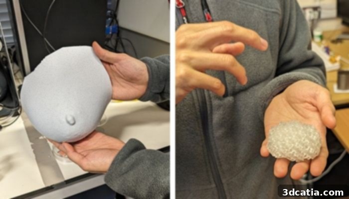 University of East Anglia 3D Printed Breast Reconstruction
