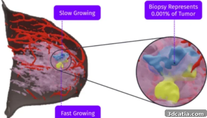 Ricoh and SimBioSys AI and 3D Printing for Breast Cancer