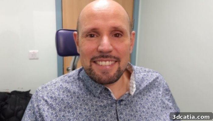 Steve Verze with his new 3D printed prosthetic eye