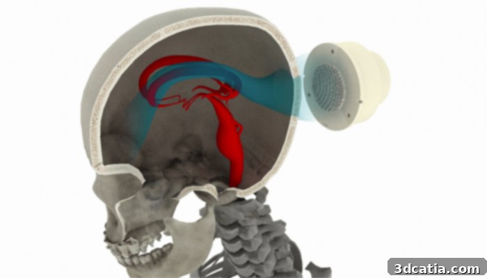 acoustic holograms for targeted drug delivery