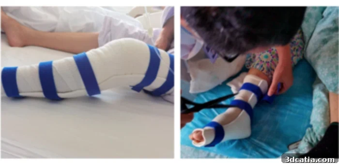 Automated external fixation system for patient treatment
