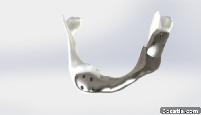 Model of the 3D printed titanium jaw