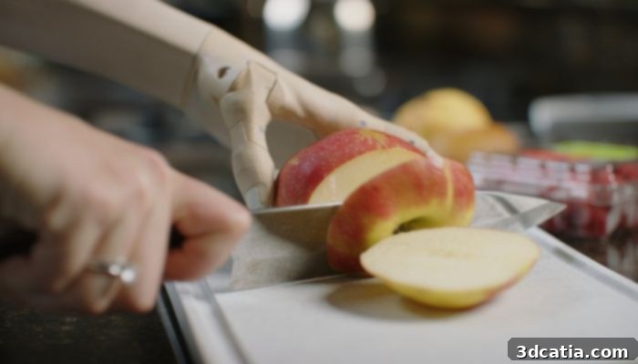 Unlimited Tomorrow TrueLimb prosthetic arm