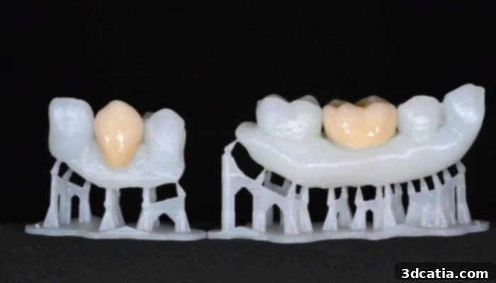 A close-up view of a precision 3D printed dental implant, ready for surgical placement.