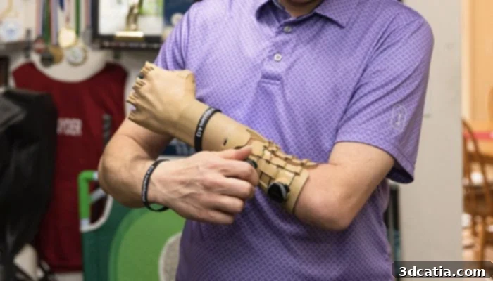Unlimited Tomorrow 3D printed bionic arm