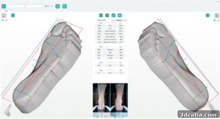 Wypro insoles designed with foot scanning