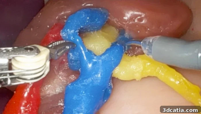 3D printing organs for surgical practice