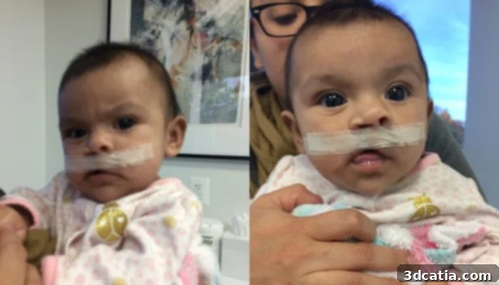 3D printing for cleft palate patients