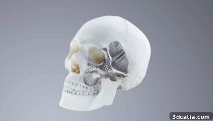 Trumpf PBF 3D printed medical implants
