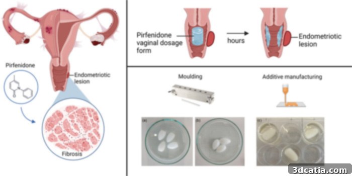 3D printed ovule for endometriosis treatment containing pirfenidone