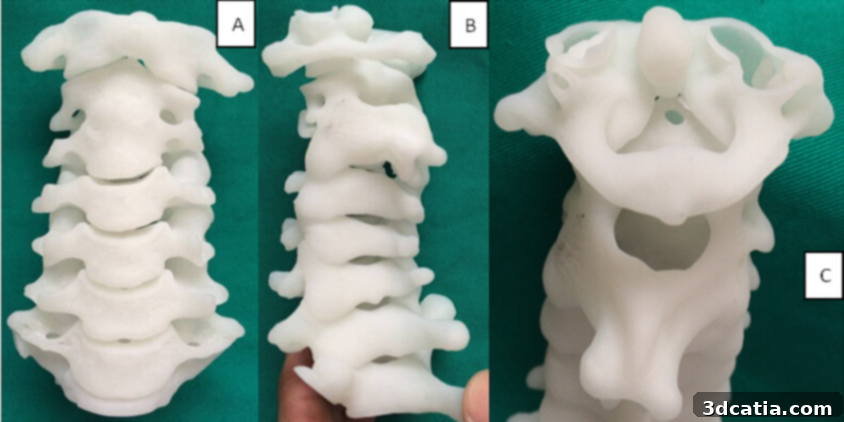 3D PRINTing SPINE