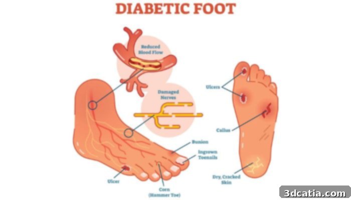 Innovative 3D printed bandage for advanced diabetic foot ulcer treatment