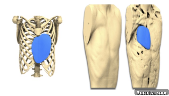 Customized 3D implant design for congenital thoracic pathologies