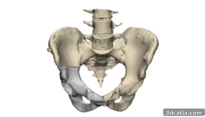Titanium has been used in traditionally manufactured and 3D printed medical fields. (Photo credits: TrabTech)