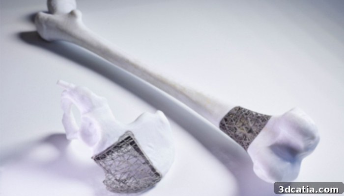 3D Printed Medical Implants Project