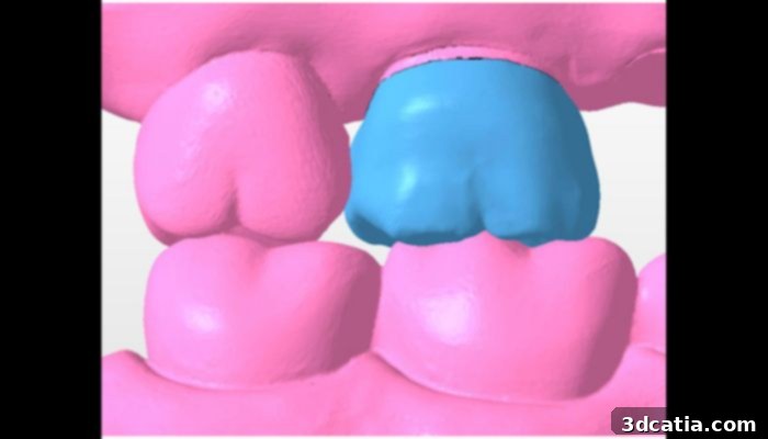 A design file for 3D printed crowns made by Dr. Clark’s students, illustrating the application of CAD in dental education.