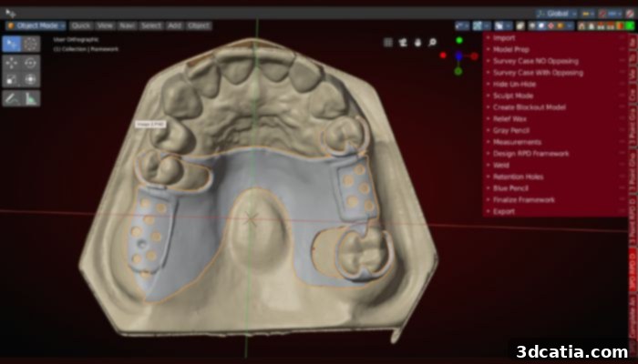 A digital design for a partial denture, showcasing the precision and customization possible with 3D printing in dentistry.